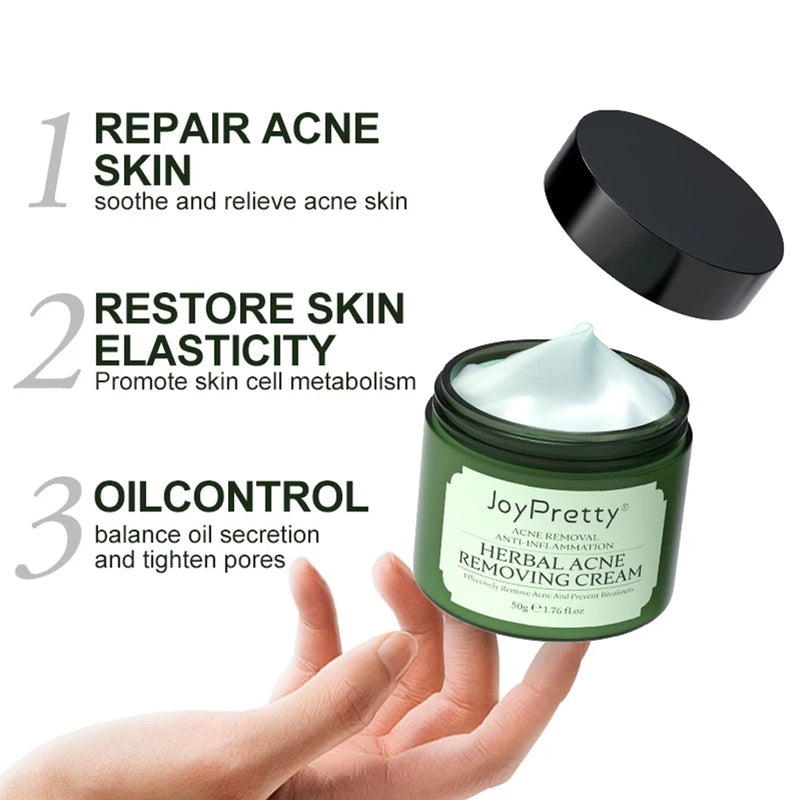 JoyPretty Herbal Acne Face Cream Body Pimple Treatment Oil Control Moisturizing Facial Creams Skin Care Products Beauty