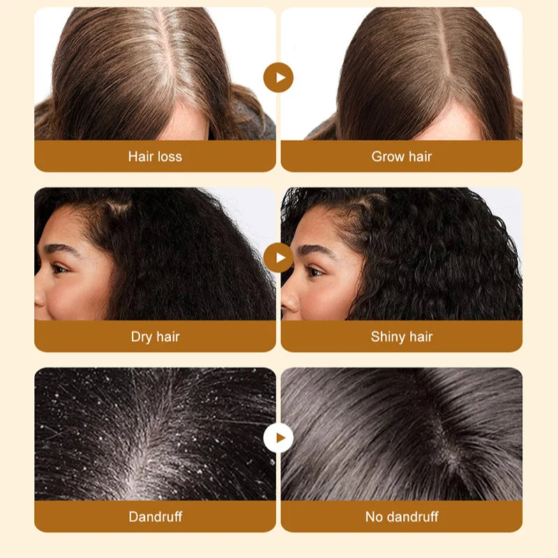 Organic Batana Oil for hair growth 100% Pure And Natural Batana Oil For Treating Hair Loss Anti-Breakage Hair